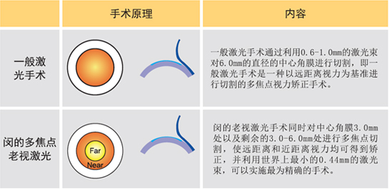 Multifocal LASIK for presbyopia